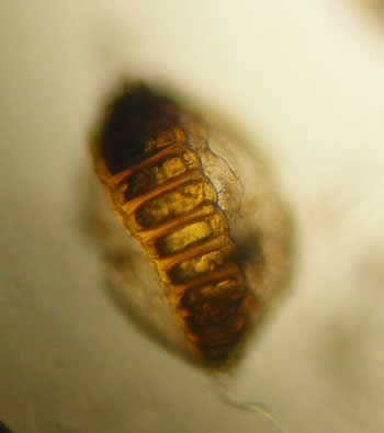 Sword Fern sorus before releasing spores
